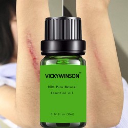 Remoção de cicatrizes e tratamento de acne - óleo de massagem lavanda 10 ml