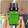 Remoção de cicatrizes e tratamento de acne - óleo de massagem lavanda 10 ml
