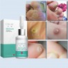 Líquido para remover etiquetas de pele - toupeiras - verrugas - clareamento sardas - 10ml