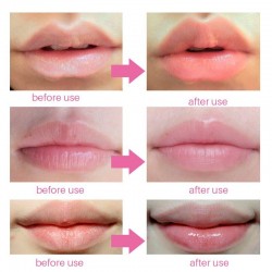 Lip gel mask - anti-wrinkle - moisturiser - collagen patches - 5 - 7 - 10 piecesMouth masks