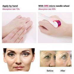 Agulha micro elétrica com LED - rolo de derma de titânio - anti-rugas - rejuvenescimento rosto / massageador do corpo