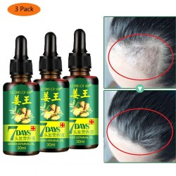 3 peças - líquido de crescimento do cabelo - essência gengibre - tratamento de 7 dias