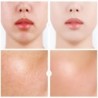 Hyaluronic acid face serum - moisturizing - shrink pores - acne marks removal - nourishingSkin