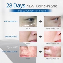 PDT LED face mask - light therapy - skin tightening / rejuvenation / dark spots remover - 7 colors