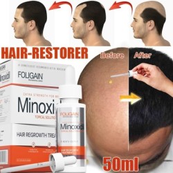 Óleo essencial de crescimento capilar - líquido anti queda de cabelo - soro