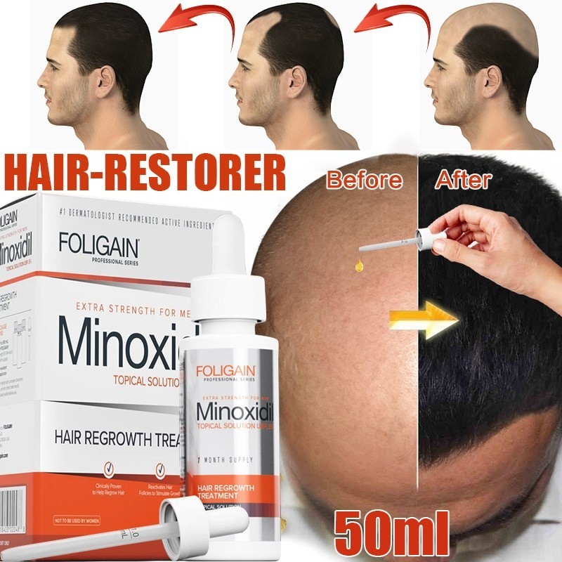 Hair growth essential oil - anti hair loss liquid - serumHair