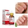 Gel removedor de fungos nas unhas - soro - anti-infecção / paroníquia / onicomicose - 10ml