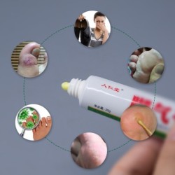 Creme para pés de atleta - anti-coceira - anti-suor - anti-odor - pés psoríase - alívio da dor - pomada antibacteriana