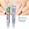 Creme para pés de atleta - anti-coceira - anti-suor - anti-odor - pés psoríase - alívio da dor - pomada antibacteriana