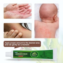 Creme de psoríase - dermatite - eczema - anti-coceira - pomada antibacteriana à base de plantas