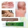 Creme de psoríase - dermatite - eczema - anti-coceira - pomada antibacteriana à base de plantas