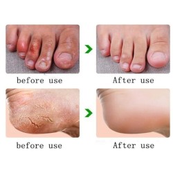 Pomada de óleo de cavalo - creme reparador de mãos / pés - hidratante