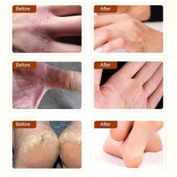 Pomada de óleo de cavalo - creme reparador de mãos / pés - hidratante