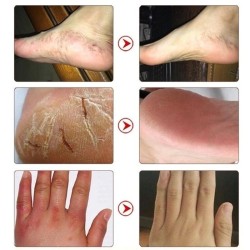 Pomada de óleo de cavalo - creme reparador de mãos / pés - hidratante