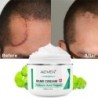 Creme desmaquilhante - estrias - acne - tratamento rosto/corpo - 50 ml