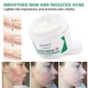 Creme desmaquilhante - estrias - acne - tratamento rosto/corpo - 50 ml