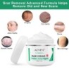 Creme desmaquilhante - estrias - acne - tratamento rosto/corpo - 50 ml
