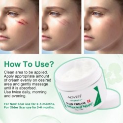 Creme desmaquilhante - estrias - acne - tratamento rosto/corpo - 50 ml