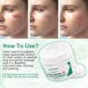 Creme desmaquilhante - estrias - acne - tratamento rosto/corpo - 50 ml