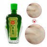 Bálsamo Vietnam - dor reumática - osteoartrite - alívio da dor - óleo de massagem - 12 ml