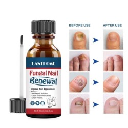 Nails antifungal oil - repair liquid serumTreatment