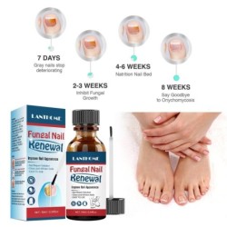 Nails antifungal oil - repair liquid serumTreatment