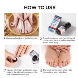 Nails antifungal oil - repair liquid serumTreatment