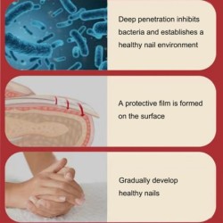 Onychomycosis removal oil - essence liquid serumTreatment