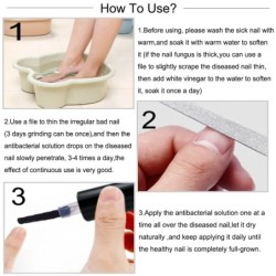 Onychomycosis removal oil - essence liquid serumTreatment