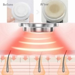 Massageador facial elétrico - rejuvenescimento da pele - lifting - remoção de rugas - mesoterapia - eletroporação - LED