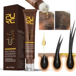 Hair growth essence - ginger oil - anti hair lossHair