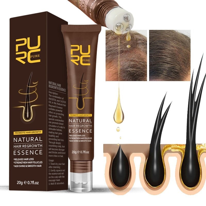 Hair growth essence - ginger oil - anti hair lossHair