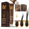 Hair growth essence - ginger oil - anti hair lossHair