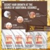 Hair growth essence - ginger oil - anti hair lossHair