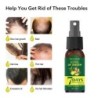 Essência de crescimento capilar - spray anti queda de cabelo