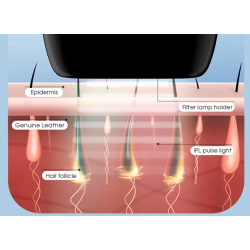 Depilador a laser - depilação permanente - IPL - 900000 - 5 marchas