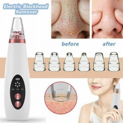 Removedor de cravos / acne - limpador de poros faciais - cuidados com o rosto por sucção a vácuo - USB