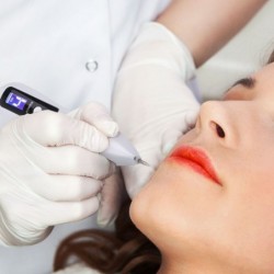 Caneta de plasma a laser - remoção de sardas / toupeiras / manchas escuras - display LCD LED