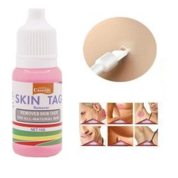 Remoção de marcas na pele - verrugas nos pés - líquido medicinal - 10ml - 2 peças