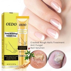 Tratamento de fungos nas unhas - creme mãos/pés/unhas - ginseng - 15 gr