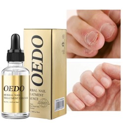 Tratamento de fungos nas unhas - óleo essencial