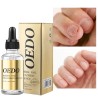 Tratamento de fungos nas unhas - óleo essencial