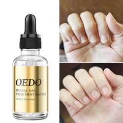 Tratamento de fungos nas unhas - óleo essencial