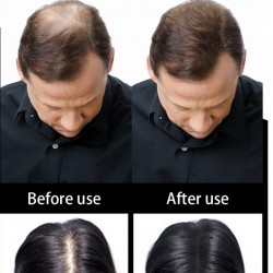 Hair thickening fiber - powder - 100gHair dye