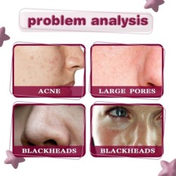 Sérum facial - essência ácida de frutas - AHA - BHA - tratamento de acne - clareamento - 30ml