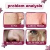 Sérum facial - essência ácida de frutas - AHA - BHA - tratamento de acne - clareamento - 30ml