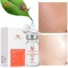 Soro facial de extrato de caracol - hidratante / clareador / anti rugas / anti acne
