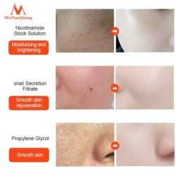 Soro facial de extrato de caracol - hidratante / clareador / anti rugas / anti acne