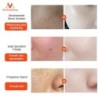 Soro facial de extrato de caracol - hidratante / clareador / anti rugas / anti acne