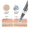 Dr.Pen - Ultima M8 W - caneta derma profissional - sem fio - microagulha elétrica para pele